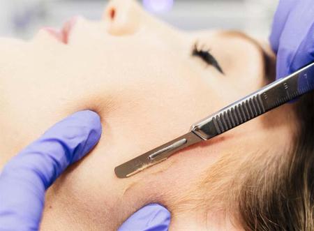 Dermaplaning Picture